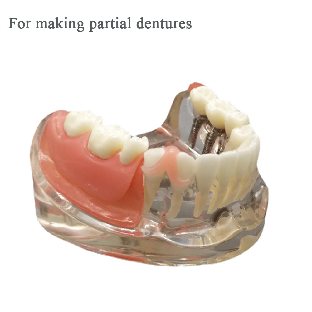 DIY Denture Tooth Repair Kit B145